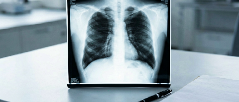 A radiologist reviewing an X-ray film on a lightbox with a pen, symbolizing final medical responsibility