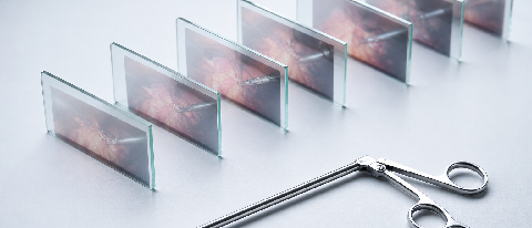 A conceptual editorial image showing a sequence of surgical frames on glass slides next to a medical tool.